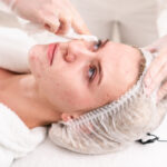 AcneTreatment8