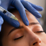 Botox1