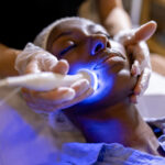 FacialRejuvenation5
