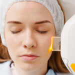 LaserPigmentation5