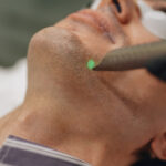 LaserTreatment3